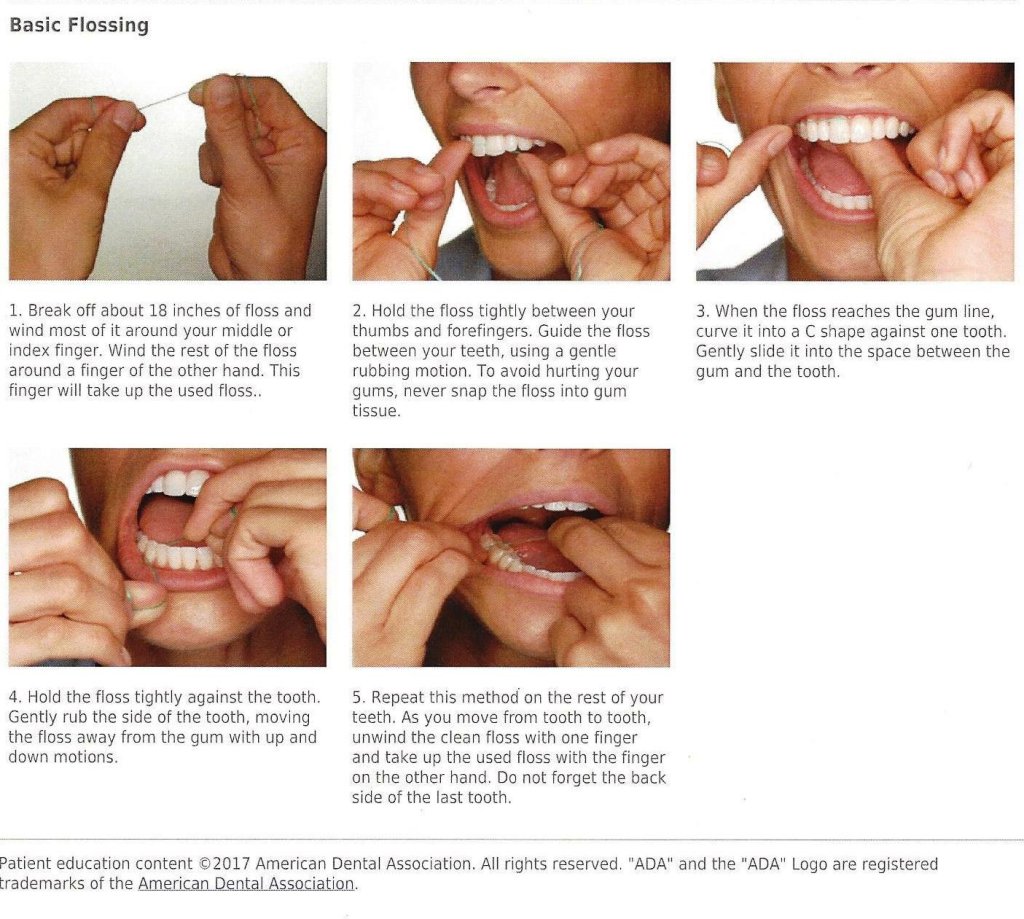 17+ How To Make Flossing Easier